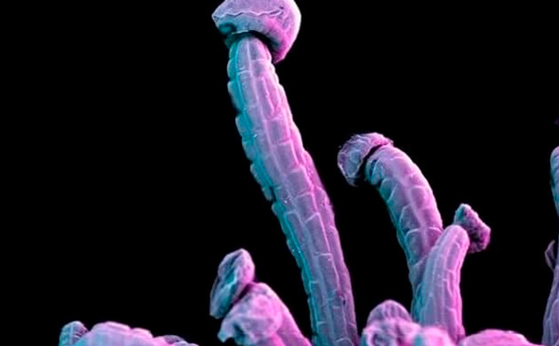 Железистые отростки на поверхности шишки Отростки в форме гриба