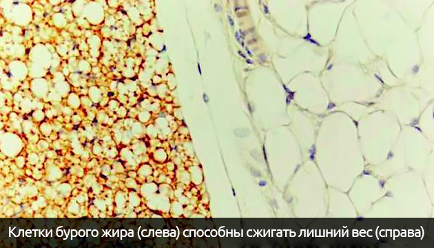 Клетки бурого жира