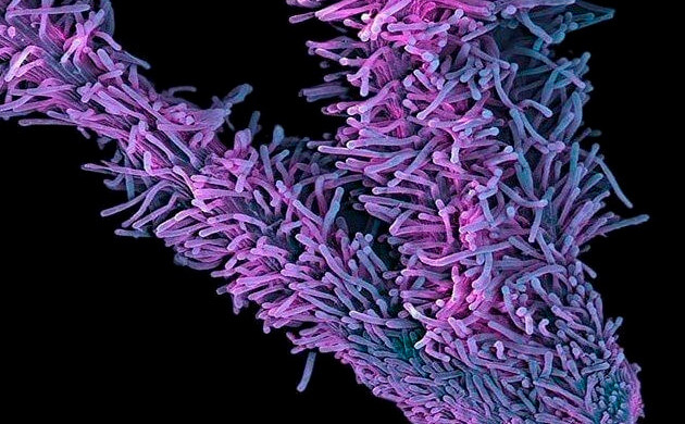 Пестик женского соцветия конопли Ворсистые пестики под микроскопом